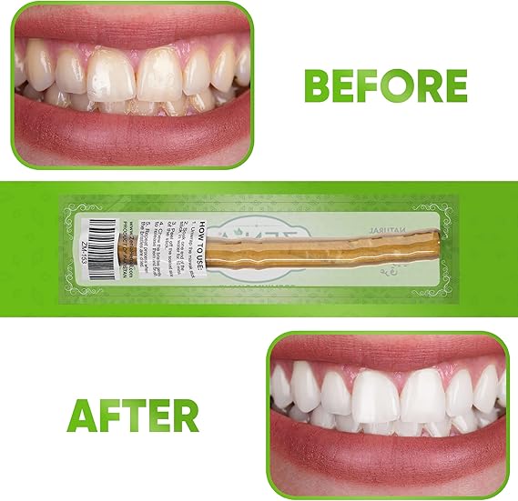 Miswak Sticks – Natural Toothbrush for Whiter Teeth & Fresh Breath